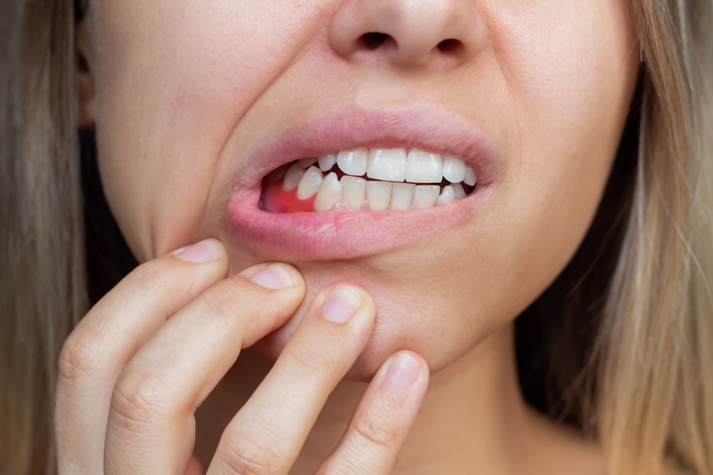 Woman experiencing symptoms of gum disease in Herrin, IL