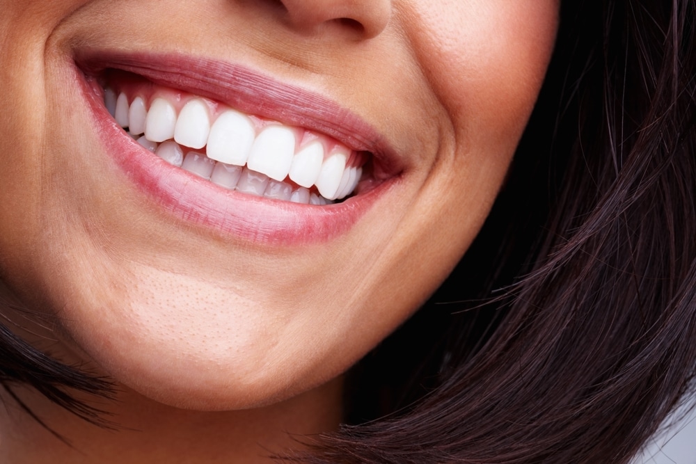 Smile Makeover Paducah KY
